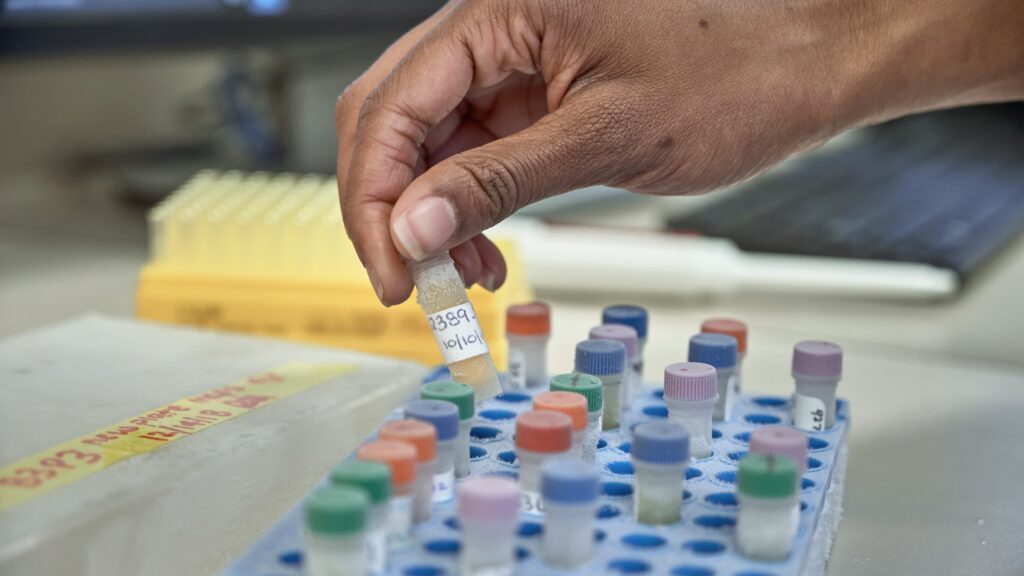 Exercise Endocrinology Lab